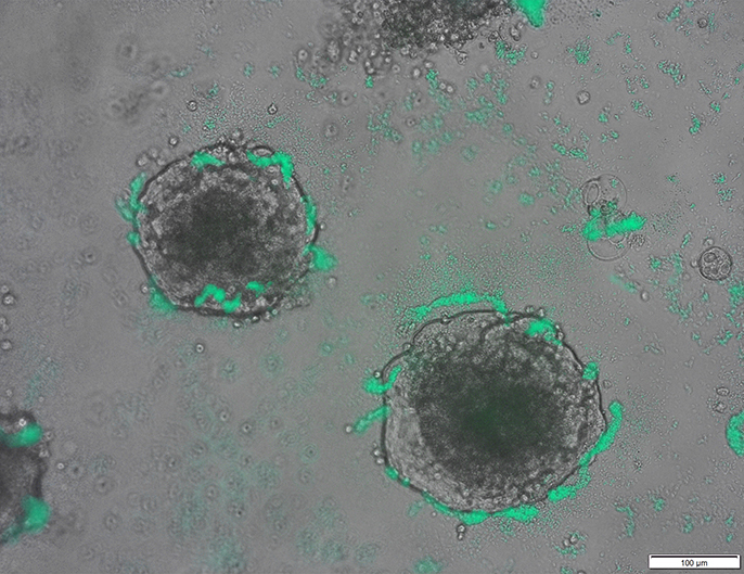 Les bactéries Acinetobacter baylyi entourent des amas de cellules cancéreuses colorectales