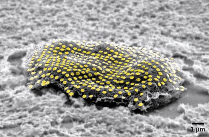 Réseau de nanopoints d'or de fausse couleur sur une cellule de fibroblaste